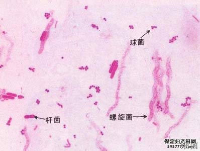 慈溪治疗阴道炎医院